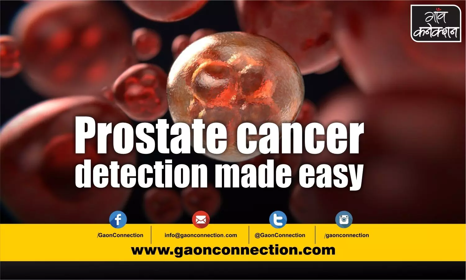 New sensor may help early detection of prostate cancer