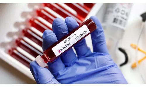 भारत में कोरोना वायरस की परीक्षण रिपोर्ट आने में लग रहा है समय, टेस्टिंग दर भी दूसरे देशों की तुलना में है काफी कम