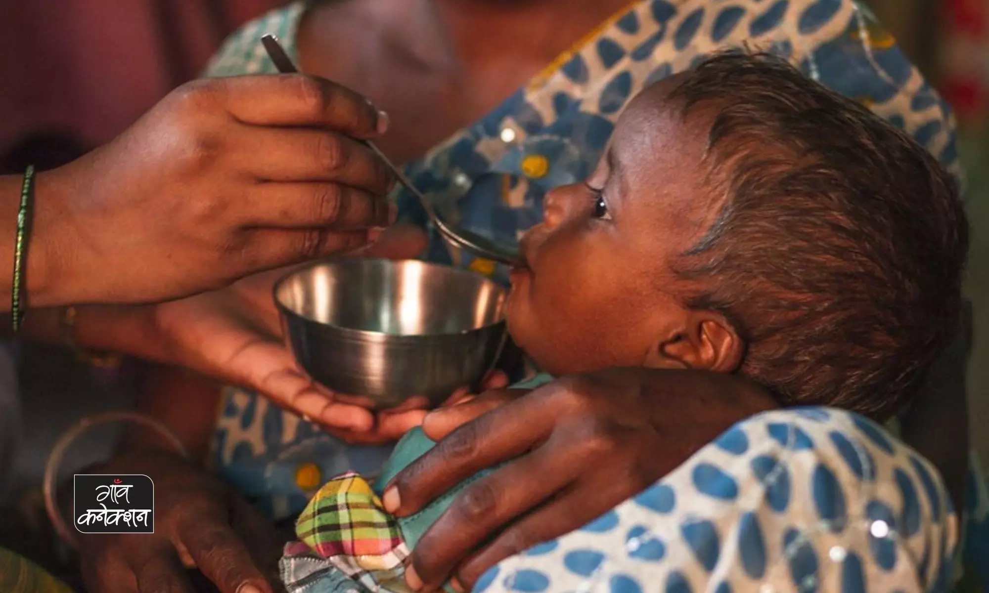 भारतीय बच्चों में गंभीर कुपोषण की कीमत आखिर कितनी है?
