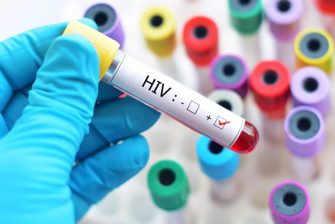एचआईवी संक्रमण रोकने में मददगार हाइड्रोजन सल्फाइड