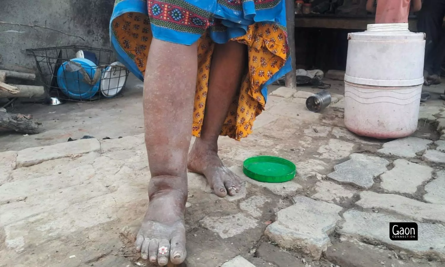 WhatsApp, Radio and Recorded Phone Messages Help Fight the War Against Filariasis