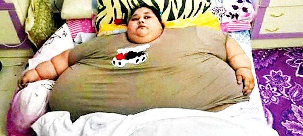इमान अहमद के मोटापे की वजह है दुर्लभ आनुवांशिक विकार