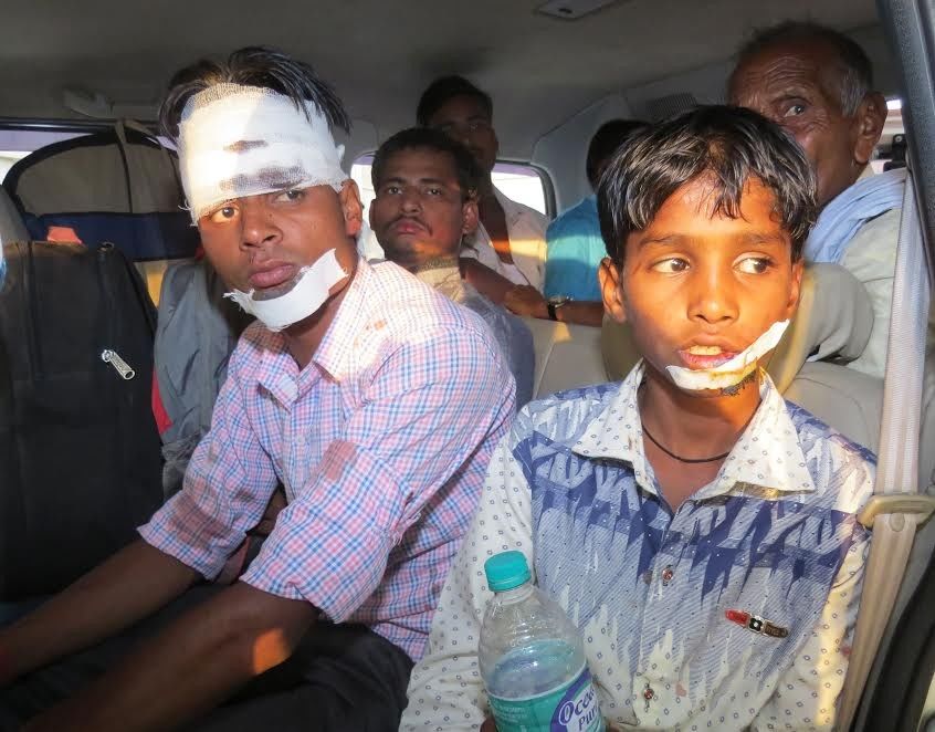 कन्नौज में बस- ट्रक में भिड़ंत , 13 बाराती घायल