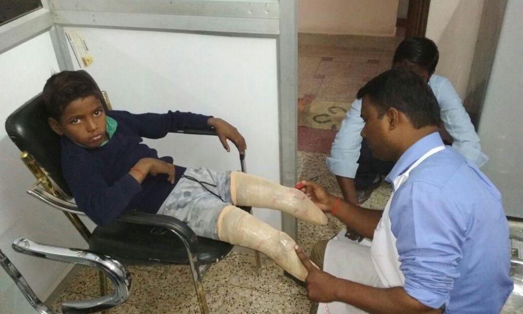 एक पुलिसकर्मी की मदद से अब अपने पैरों पर चल पाएगा दिव्यांग शिवा